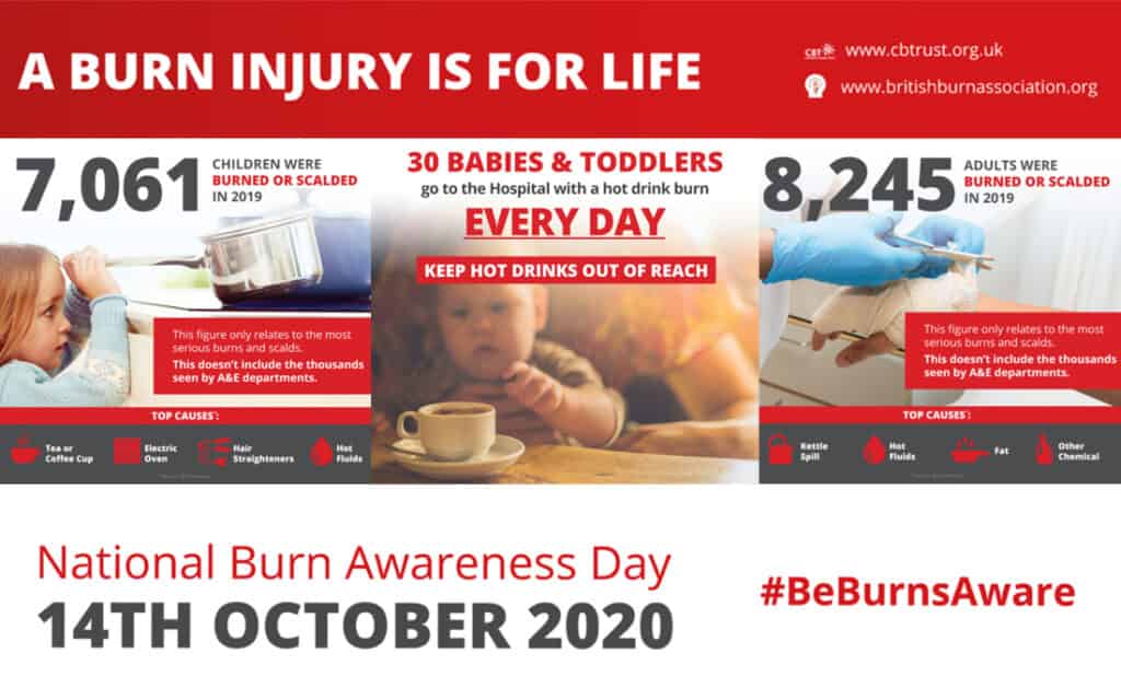 A burn injury is for life. This image outlines the numbers of children and adults scalded or burnt  in 2019